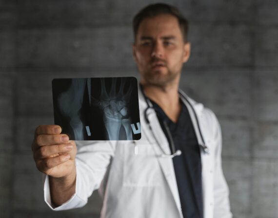 Doctor reading x-ray